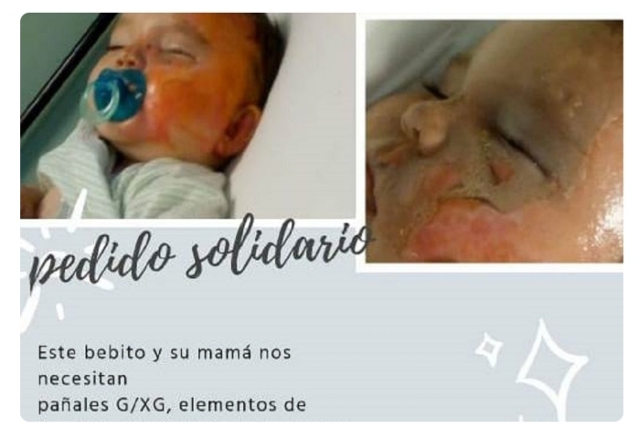 El pedido de ayuda