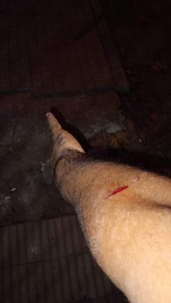 Lesiones en agentes Lesiones en agentes