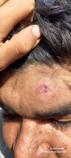El rostro con lesiones de la víctima El rostro con lesiones de la víctima